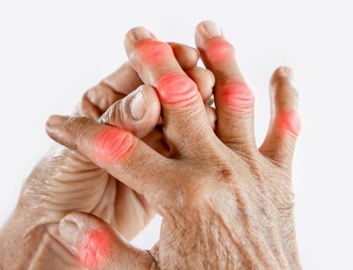 Dolor de articulaciones